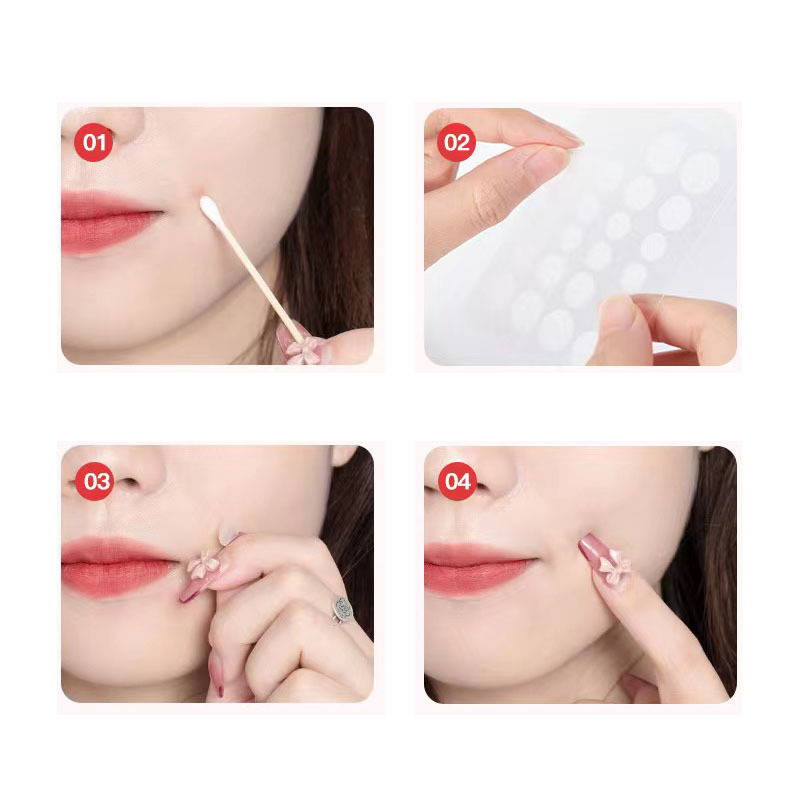 pockmarked edge type