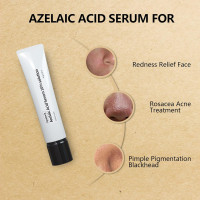 10% Azelaic Acid Serum Solution Apatock,Rosacea Treatment for Face,Dark Spot Remover,Redness Relief for Face,Natural Extracts Gently Acne Treating (1.4 oz(Pack of 1))