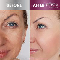 Retinol Anti-Aging Hand Cream – The Original Brand For Younger Looking Hands –Rich, Velvety Hand Cream Conditions & Protects Skin, Nails & Cuticles – Vitamin A Minimizes Age’s Effect on Skin 3.4 Ounce (Pack of 1)