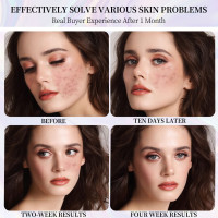 Laf Bktt Led Face Mask Light Therapy, Red-Light-Therapy for Face, 7 Colors Skin Care Mask for Face and Neck at Home