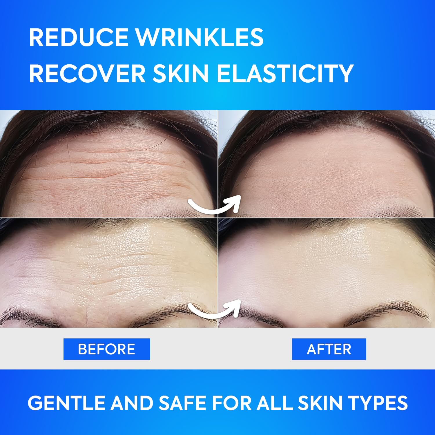 Forehead Wrinkle Patches 12Pcs with Aloe, Collagen, Vitamin E, Anti Wrinkle Patches, Forehead Wrinkles Treatment Blue(12 Forehead)