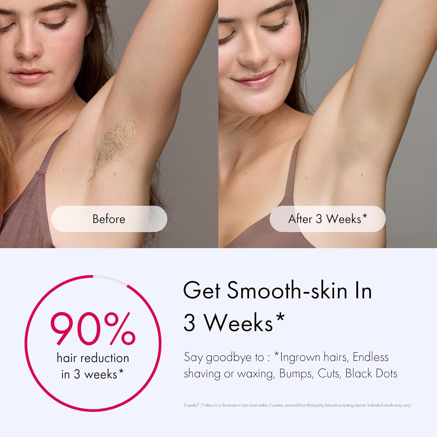 Ulike Laser Hair Removal for Women and Men, Air 3 Ice-Cooling IPL Hair Removal Device for Nearly Painless & Long-Lasting Results, 3 Modes & Auto Flashing for Fast Full Body Hair Removal from Home Purple