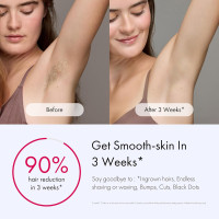 Ulike Laser Hair Removal for Women and Men, Air 3 Ice-Cooling IPL Hair Removal Device for Nearly Painless & Long-Lasting Results, 3 Modes & Auto Flashing for Fast Full Body Hair Removal from Home Purple