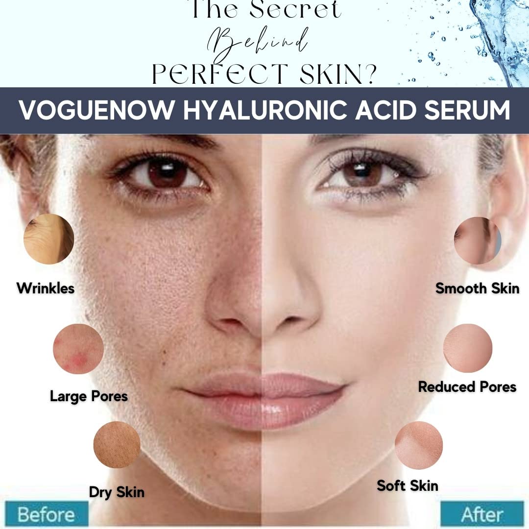 Hyaluronic Acid Serum Ampoules Pack (10pc) - Boosts Light Therapy Results - Anti Wrinkle and Anti Aging Serum - Moisturizing and Hydrating Facial Serum. Light therapy Hyaluronic Acid Serum