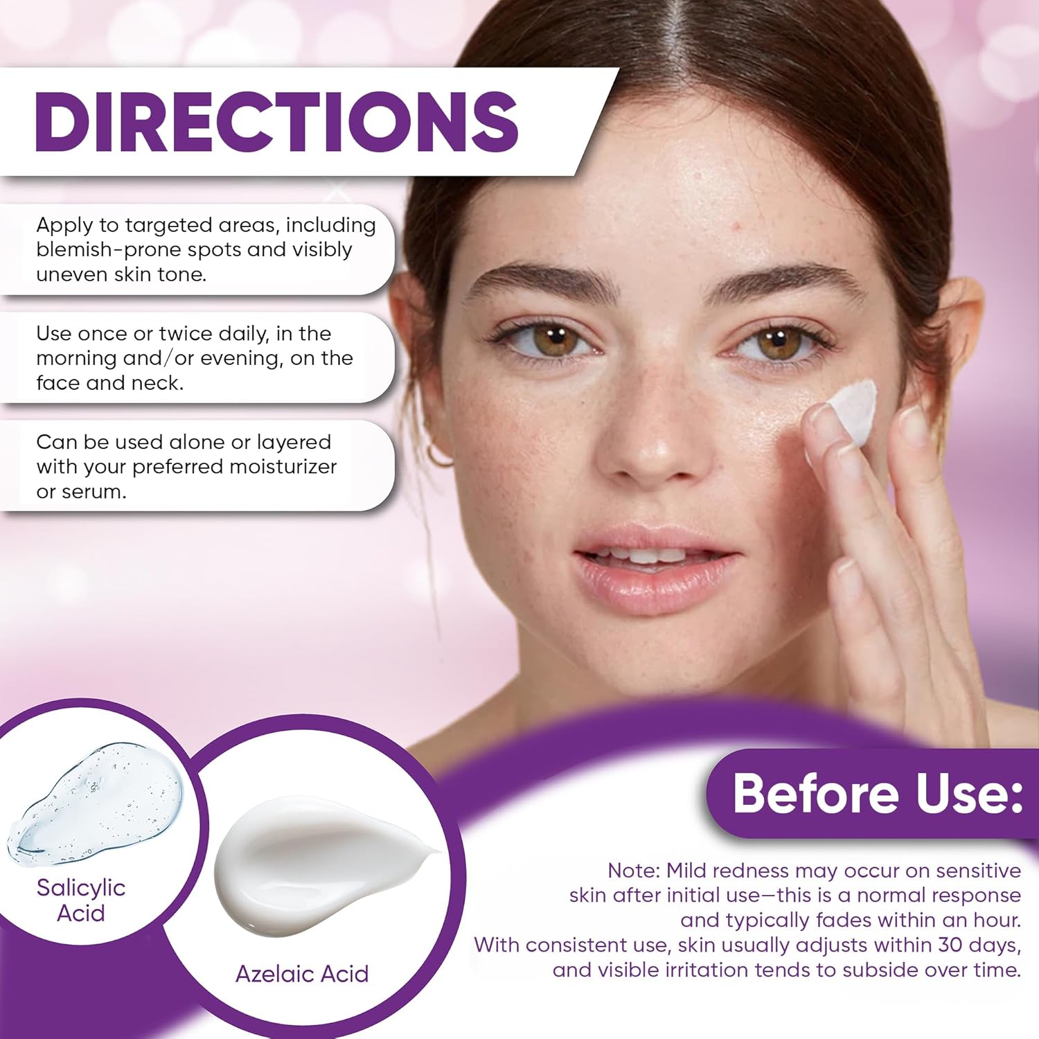 Azelaic Acid Acne Cream: Azelaic Acid For Face - Premium Azelaic Acid Cream - Face Skin and Beauty Care - Azelaic Acid Facial Cream, 1.01 Oz