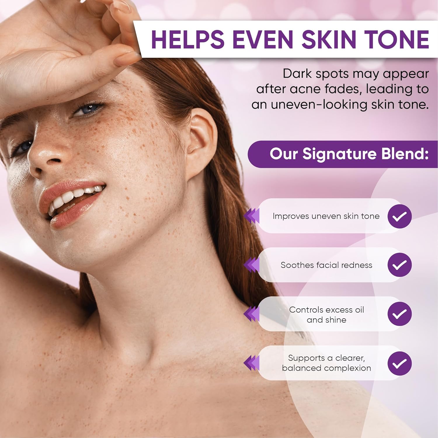 Azelaic Acid Acne Cream: Azelaic Acid For Face - Premium Azelaic Acid Cream - Face Skin and Beauty Care - Azelaic Acid Facial Cream, 1.01 Oz