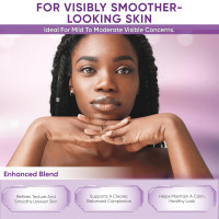 Azelaic Acid Facial Cream: Azelaic Acid For Face - Premium Azelaic Acid Cream - Face Skin and Beauty Care - Azelaic Acid Facial Cream, 1 oz