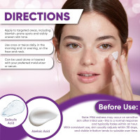 Azelaic Acid Acne Cream: Azelaic Acid For Face - Premium Azelaic Acid Cream - Face Skin and Beauty Care - Azelaic Acid Facial Cream, 1.01 Oz