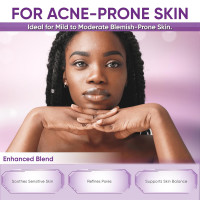 Azelaic Acid Acne Cream: Azelaic Acid For Face - Premium Azelaic Acid Cream - Face Skin and Beauty Care - Azelaic Acid Facial Cream, 1.01 Oz