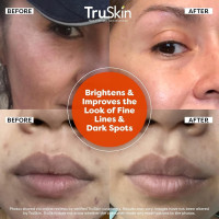 TruSkin Vitamin C Serum For Face – Anti Aging Formula with Vitamin C, Hyaluronic Acid, Vitamin E – Brightening Serum – Improve Appearance of Dark Spots, Tone, Fine Lines & Wrinkles, 1 Fl Oz 1 Fl Oz (Pack of 1)