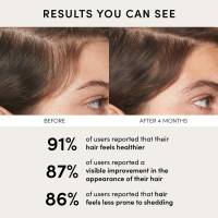 OUAI Scalp Serum - Balancing Hair Serum with Red Clover Extract, Siberian Ginseng and Peptides for Thicker and Fuller-Looking Hair - Paraben, Phthalate and Sulfate Free Scalp Care (2 Fl Oz) No Color 2 Ounce (Pack of 1)