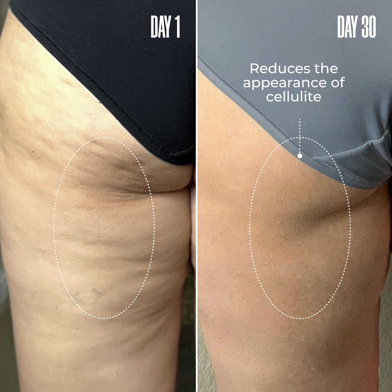 MAËLYS Cosmetics B-TIGHT Leave-On Cellulite Mask - Reduces The Appearance Of Cellulite - Visibly Tightens The Skin In The Butt Area 2 Pack