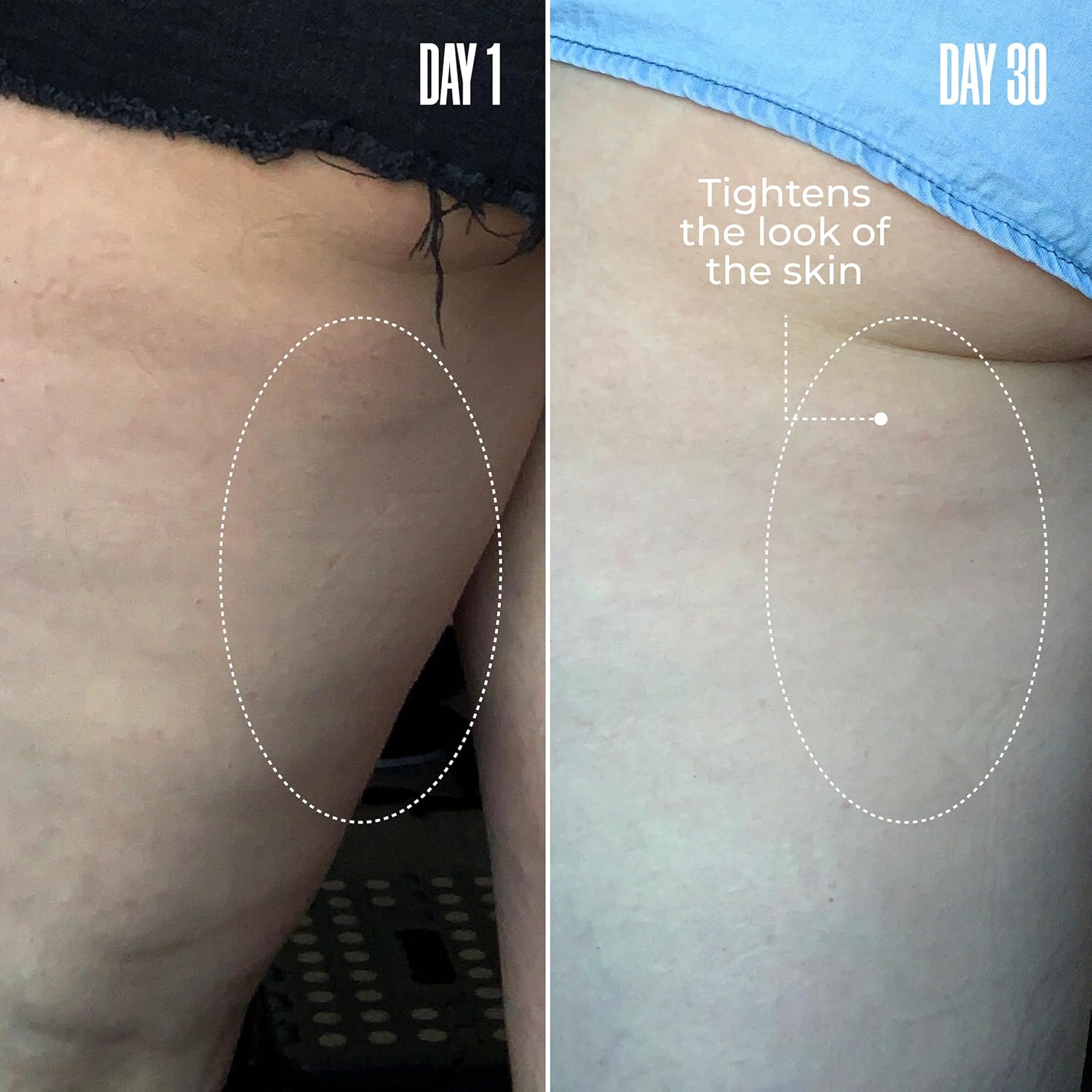 MAËLYS Cosmetics B-TIGHT Leave-On Cellulite Mask - Reduces The Appearance Of Cellulite - Visibly Tightens The Skin In The Butt Area 2 Pack