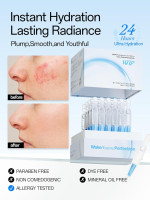 WNP Hyaluronic Acid Serum 3% for Face with 4D Multi-Layer Hydration | Ultra Hydrating Anti-Aging Serum | Moisturizer for Dry & Sensitive Skin | Pre-Makeup Skincare | Single-Use Vials 30PCS 30 vials (36 ml)