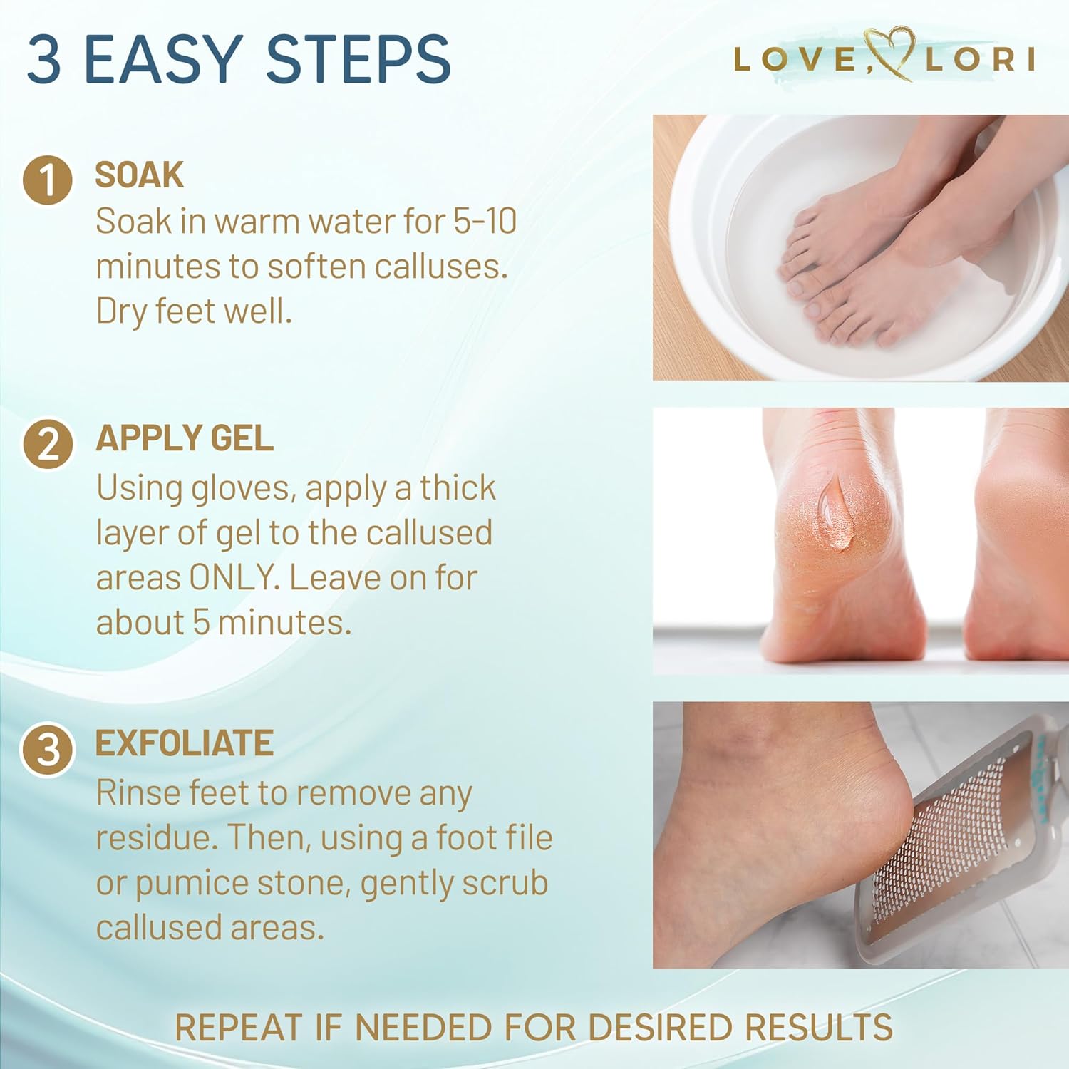 Callus Remover for Feet (Extra Strength) Foot Callus Remover Gel - Pedicure Tools for Feet Scrubber – Foot Care Spa Essentials, 6oz