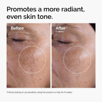 The Ordinary Glycolic Acid 7% Exfoliating Toner, Brightening and Smoothing Daily Toner for More Even-Looking Skin Tone 8.11 Fl Oz (Pack of 1)