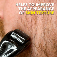 The Beard Club Derma Roller for Face, Body and Scalp - Microneedling for Men and Women with 540 Titanium Microneedles - Beard Roller & Micro Needling Scalp Hair - Black Derma Roller - Black