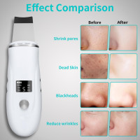 Face Scrubber Skin Spatula - Blackhead Remover Deep Cleansing Tool for Pore Extraction, 4-in-1 Fast Charging Dock Blackhead Remover Face Spatula for Facial Skincare Women Gift (White)