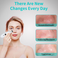 Face Scrubber Skin Spatula - Blackhead Remover Deep Cleansing Tool for Pore Extraction, 4-in-1 Fast Charging Dock Blackhead Remover Face Spatula for Facial Skincare Women Gift (White)