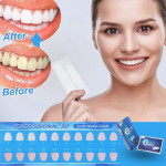 Teeth Whitening Strips Mint Flavor