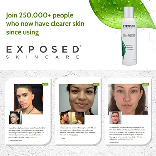 Wholesale Exposed Skin Care Acne Facial Cleanser - Gentle Face Wash with Salicylic Acid for Acne Prone Skin - Pore Acne Treatment for All Ages, Skin Types : Beauty & Personal