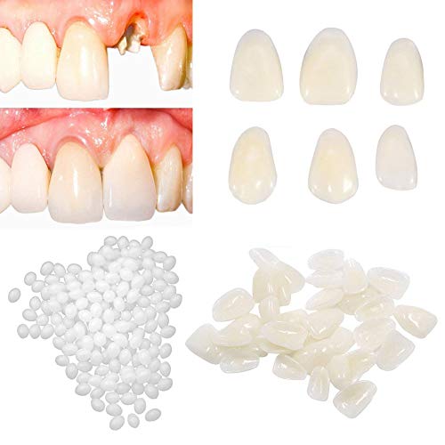 Tooth Repair Kit, Moldable False Teeth for Beautiful Smile, Dental